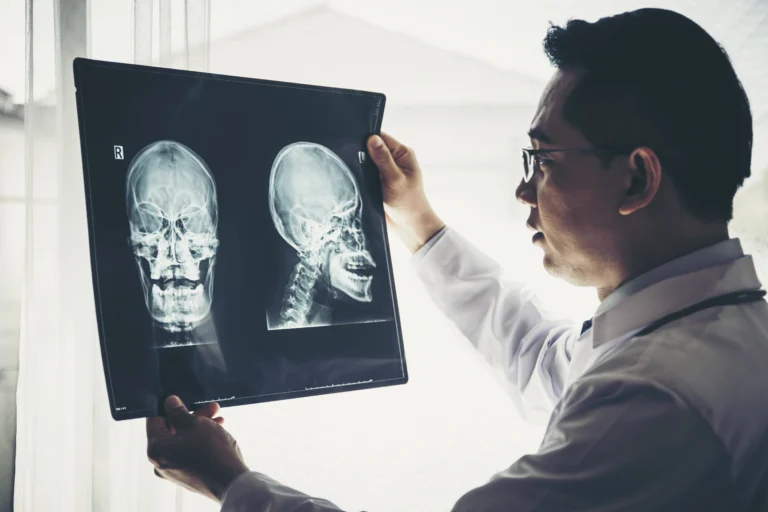 close-up-of-doctor-holding-x-ray-x-ray-film-of-pa-2023-11-27-04-51-32-utc